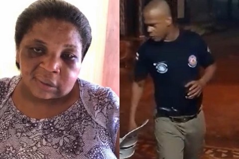 Mulher agredida por policial militar em bar aparece em vídeo com hematomas no rosto