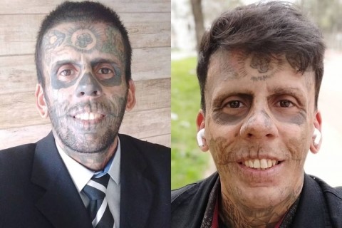 Convertido, homem mais tatuado do Brasil começa a remover tatuagens