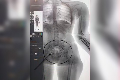 Mulher é presa após tentar entrar em presídio com droga escondida nas partes íntimas na Bahia