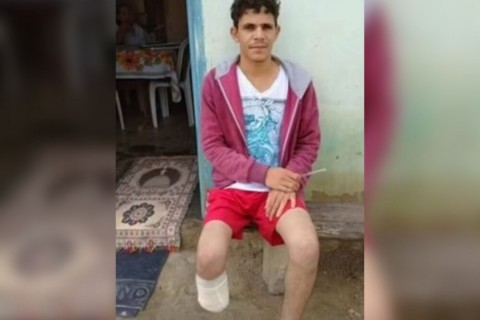 Pé de servidor que amputou o próprio membro para tentar receber R$ 1,5 milhão foi encontrado dentro da mochila dele