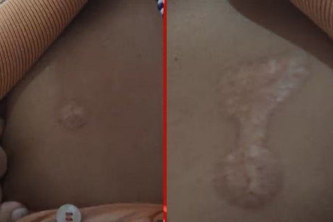 Pai de santo é investigado por queimar umbandistas com ferro quente e charutos durante rituais na Bahia