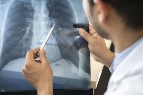 Tabagismo é maior entre jovens de 16 a 24 anos, alerta pesquisa
